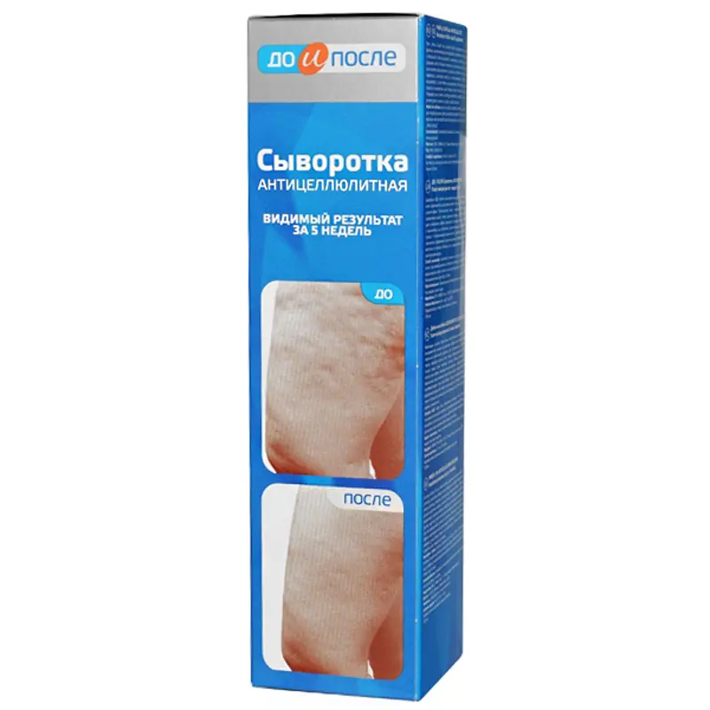 ДО И ПОСЛЕ сыворотка антицеллюлитная 130мл (ТВИНС ТЭК, РФ)