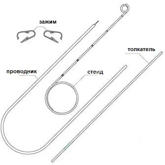 СТЕНТ МОЧЕТОЧНИКОВЫЙ с проводником закр р.СН-06 24см арт.510069 (Пласти-мед, ТУРЦИЯ)