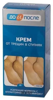 ДО И ПОСЛЕ крем для ног от трещин 150мл (ТВИНС ТЭК, РФ)